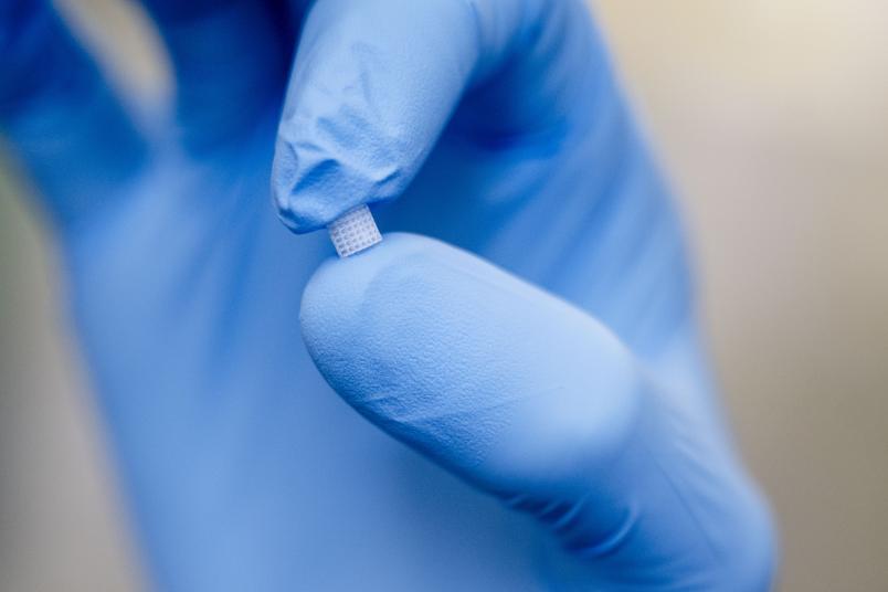 Aus computertomografischen Bildern haben die Forschenden die Struktur menschlicher Knochen abgeleitet und im 3D-Drucker nachgebildet. © RUB, Marquard Nahaufnahme einer Hand mit blauem Schutzhandschuh, die ein extrem kleines, gitterartig strukturiertes Plättchen (Mikrochip) präsentiert. Der Hintergrund ist unscharf.