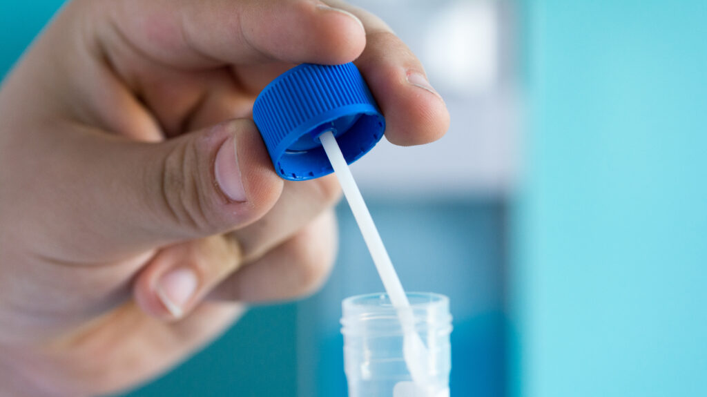 © Kunstzeug/adobe.stock.com - Im Projekt MikrobiomProCheck werden Stuhlproben analysiert, um das Darmmikrobiom bei chronisch-entzündlichen Darmerkrankungen besser zu verstehen und künftig für personalisierte Therapien nutzbar zu machen. Eine Hand hält eine blaue Kappe, an der ein weißer Probenentnahmestab befestigt ist, und positioniert ihn über dem Rand eines offenen, durchsichtigen Probenröhrchens.